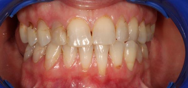 Jason Cellars, DDS - Sea Cliff Dental