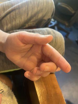 We have gotten two more pieces of fiberglass out of his hand and counting using my son's toy microscope to locate them.