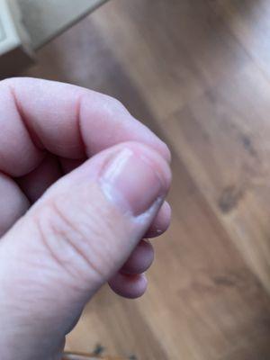 super short nail, no length left