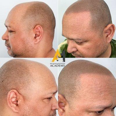 Micropigmentation Academy & Clinic