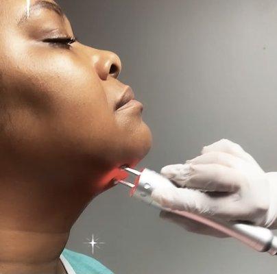 Fat dissolve and facial tightening