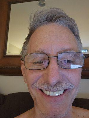 Amazing front teeth!