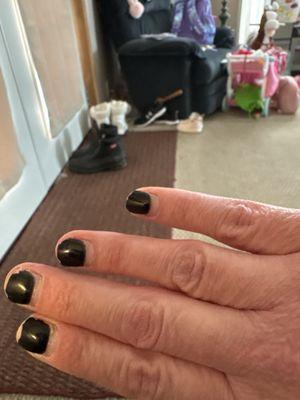 Infected nails and cuticles.