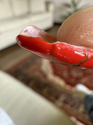 This is what it looked like after fixing