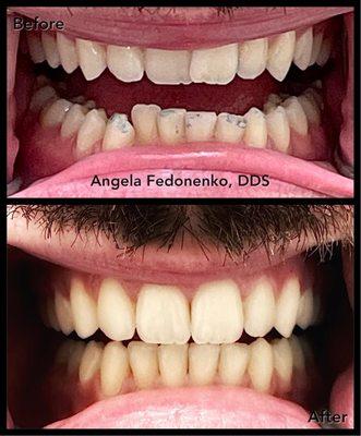 Angela Fedonenko, DDS