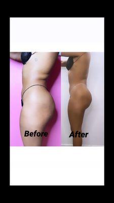 Results from Body Wraps
