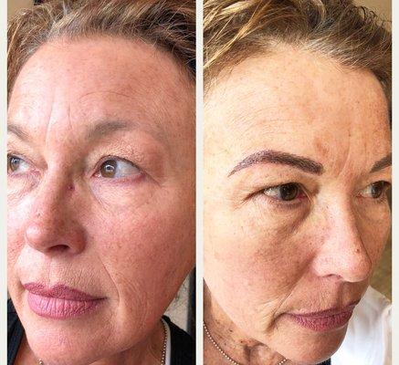 Before and after of hair stroke cosmetic tattooing .