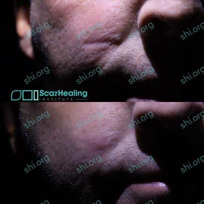 Scar Healing Institute