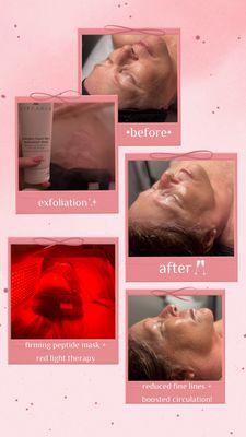 Age Perfecting Facial