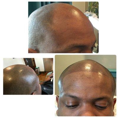 Adding a edge-up with scalp pigmentation, Near Dallas