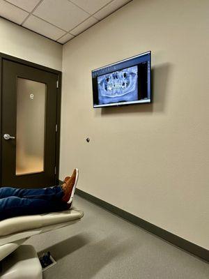 11/17/25 X-ray results on TV