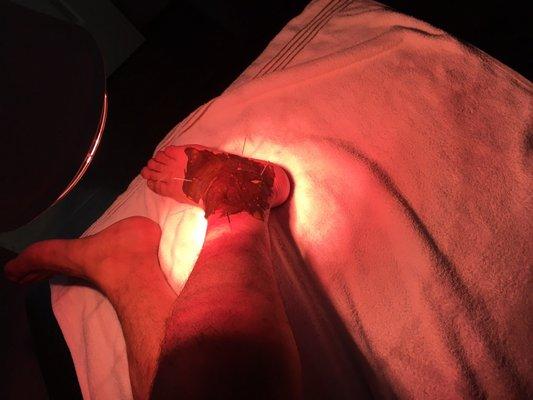 Grace & Qian Acupuncture