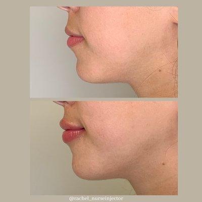 Illuminate Plastic Surgery