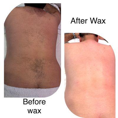 Back facial and wax treatment
