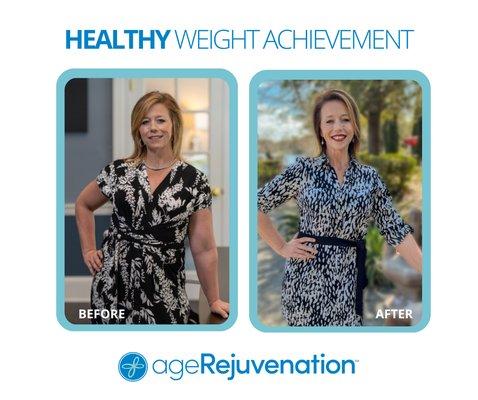 AgeRejuvenation - Brandon