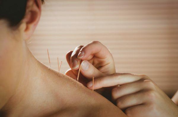 Green Chiropractic and Acupuncture