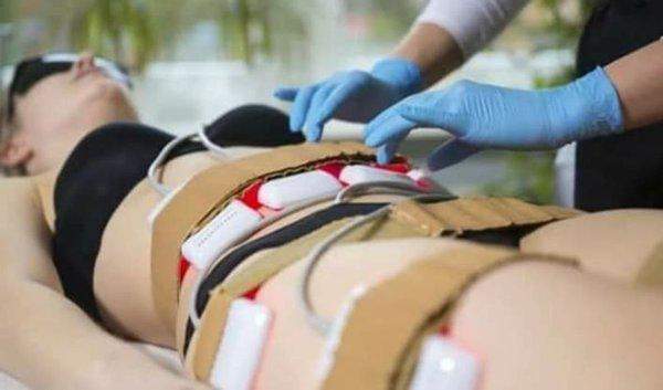 Lipo Laser, cavitation, vacuum therapy and radio frequency