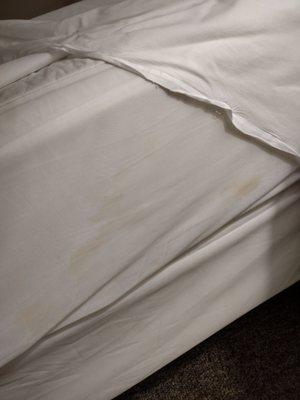 Dirty yellow stains on sheets