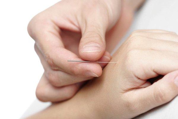 Stillpoint Acupuncture