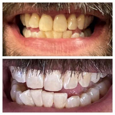 Brite Smiles By Heather