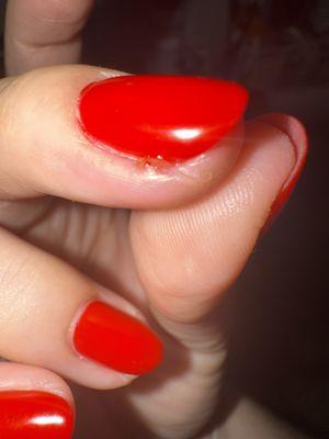 Day 2 after manicure