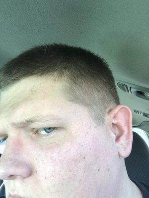 Left side