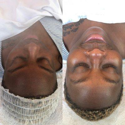 Before and after facial glow with gua sha massage