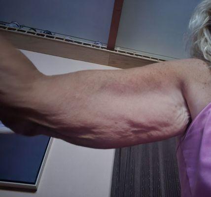 Phillip Dahan, MD, FACS