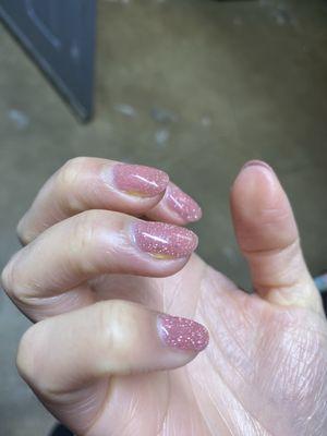 You can see here on my right hand two yellow spots on my nails.