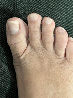 Right foot