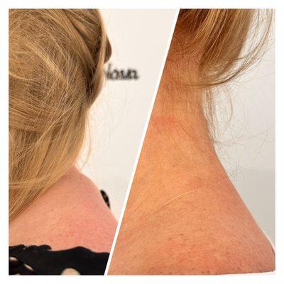 working with the neck area