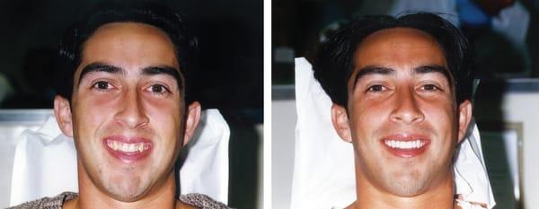 Before and After Photo