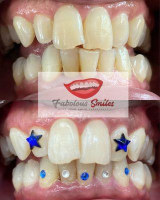 1 Hour Teeth Whitening Session & Speciality Cluster Tooth Gem Design