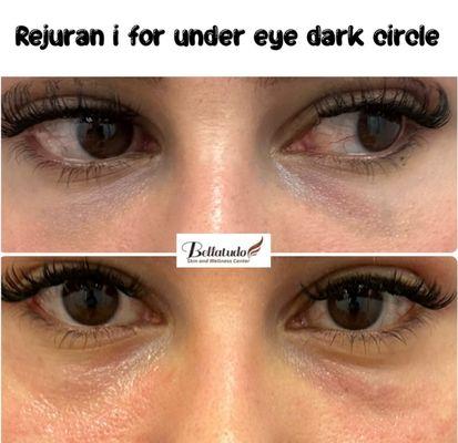 Bellatudo Skin and Wellness Center