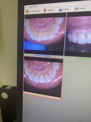 Before and after cleaning!