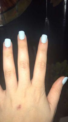 Polish outside the nail. Cuts in the cuticles.