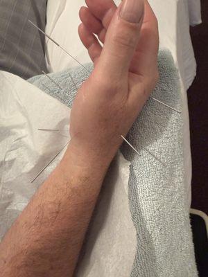 Eileen Yue Ling Han Acupuncture