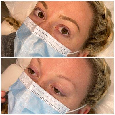 Immediately felt more confident with these new brows! My only regret is that I didn't get them done sooner!