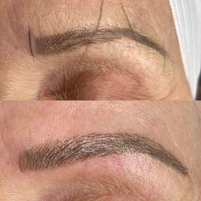 Before and after: "old brow" correction
