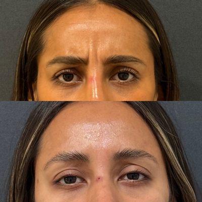 Renew Laser & Aesthetic Medicine