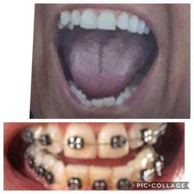 Before and during treatment