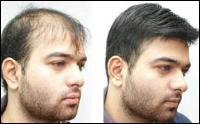 Images International