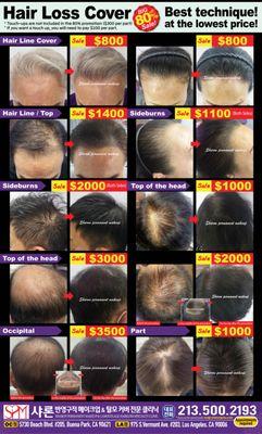 Get ready for the BIGGEST HAIR LOSS
COVER sale of the year!
* 80% OFF our best-selling solution
* Experience the latest technique!