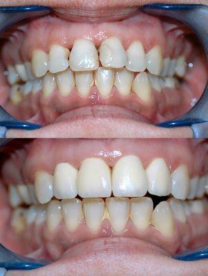A Brilliant Smile Dental