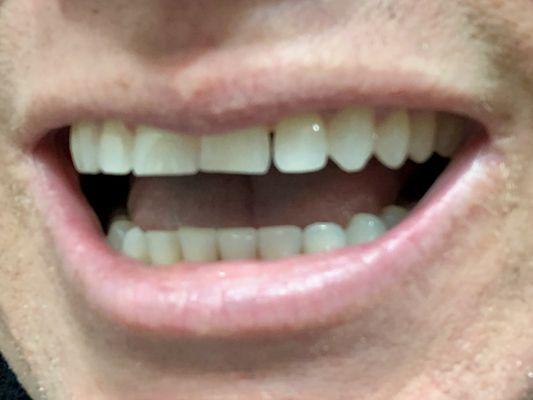 Gap moved from middle to side!