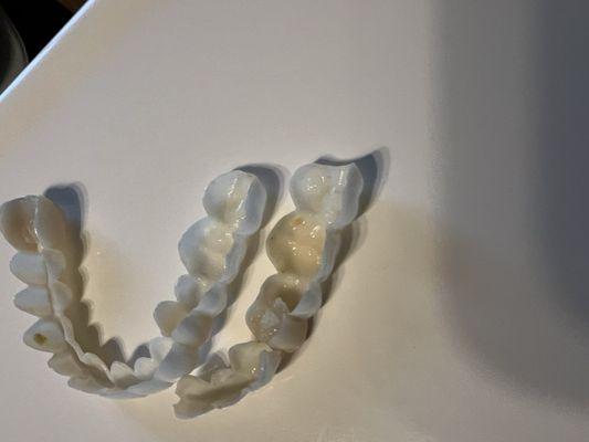 Removable Veneers USA