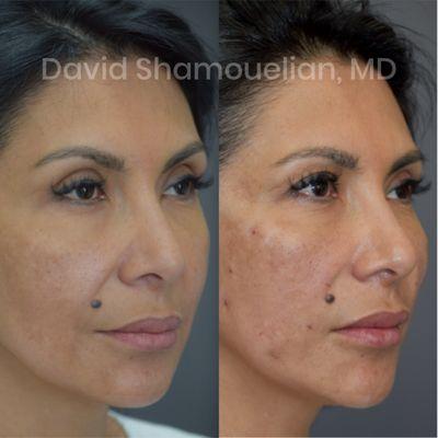 Allure Aesthetic Surgery of Beverly Hills