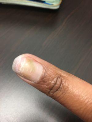 WORST NAIL SHOP EXPERIENCE EVER