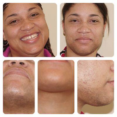 We can help remove those dark spots and give you that natural glow, man or woman, that you deserve!!!