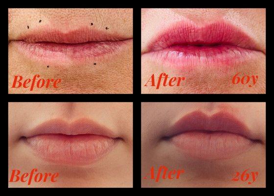 Graceful Lines Aesthetics